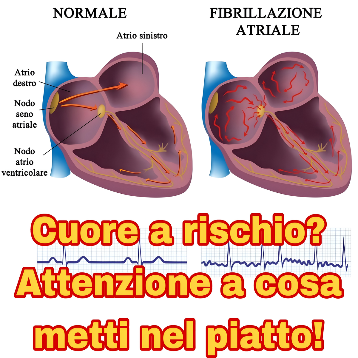 Fibrillazione atriale: cosa mangiare (e cosa evitare) per proteggere il cuore
