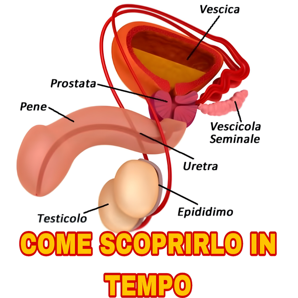 Rivoluzione nella diagnosi del tumore alla prostata: basta un test delle urine per scoprirlo in tempo!