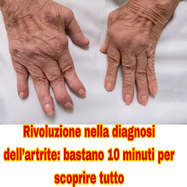 Artrite? Ora basta un test sul liquido sinoviale per scoprirla in 10 minuti