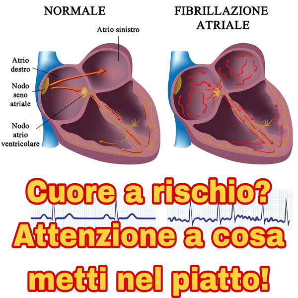 Fibrillazione atriale: cosa mangiare (e cosa evitare) per proteggere il cuore